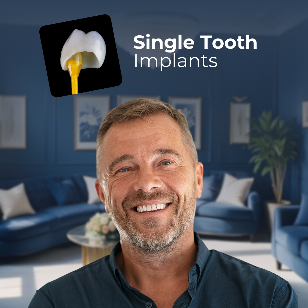 Single Tooth Implants